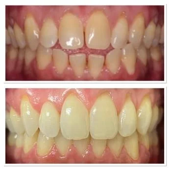 7c7160f5-img-0246_109m09m09l09m000000000