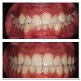 bb8656a8-img-2637_109m09m09l09m000000000